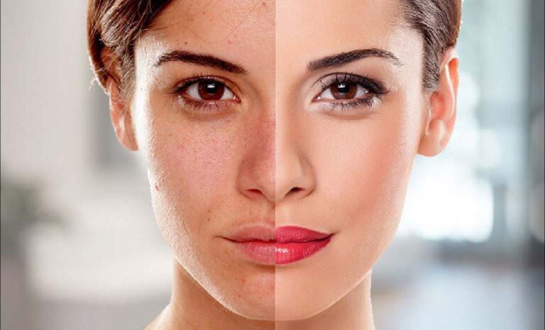 Laser Skin Clinic Dubai Laser Skin Treatment Dubai