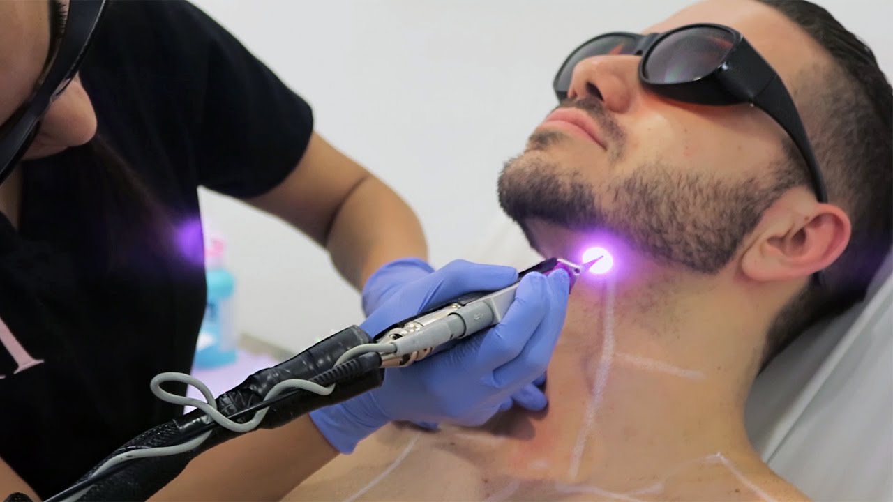 hair-removal-laser