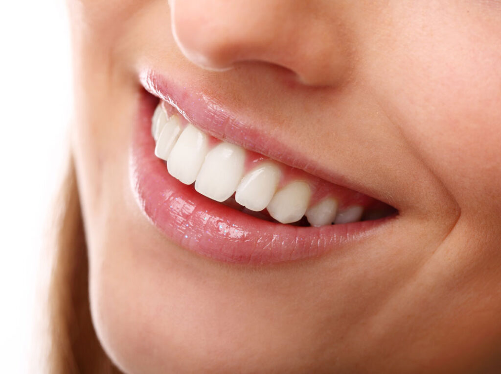 Hollywood Smile Dental Clinic Dubai