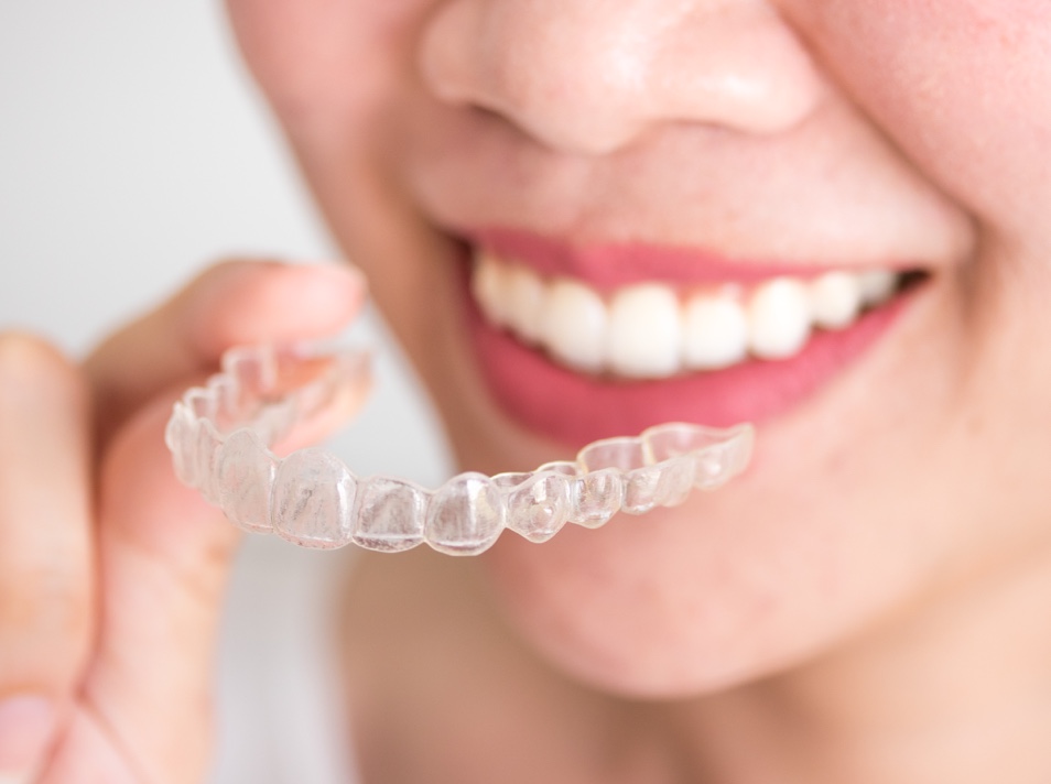 Invisalign treatment dubai marina