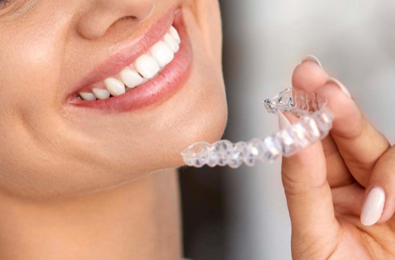 Invisalign Dubai The Clear Choice for Straighter Teeth 2023