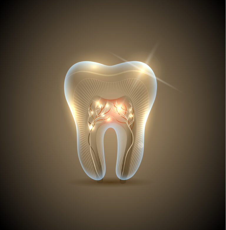 root canal treatment dubai