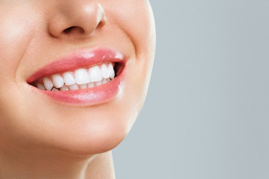 Teeth whitening Dubai