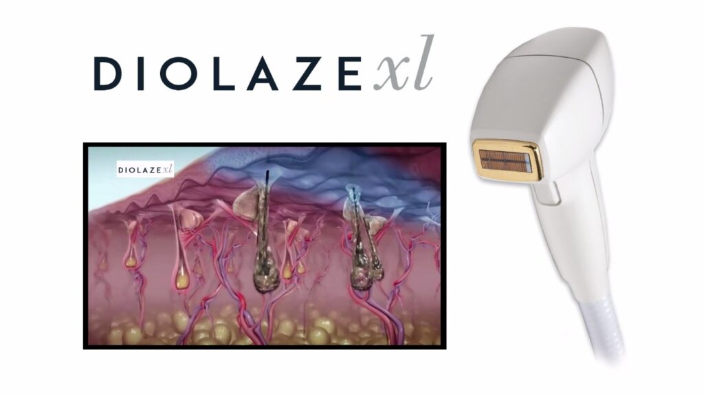 Laser Hair Removal Dubai amazing Full Body in dubai 2023