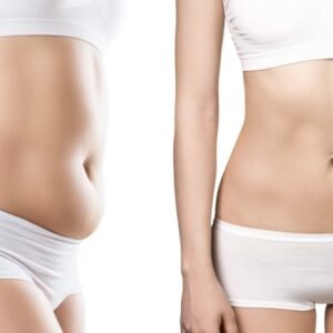 Mesotherapy for slimming