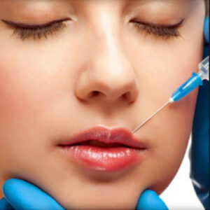 Botox for Lip