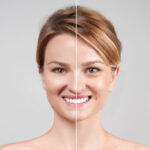 botox treatment dubai