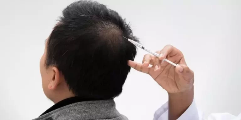 علاج الشعر بالخلايا الجذعية في دبي