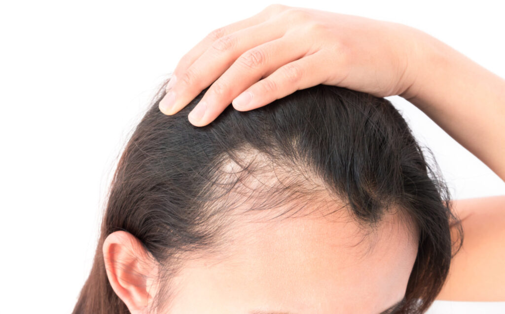 g cell hair loss treatment Dubai The best gift in 2022