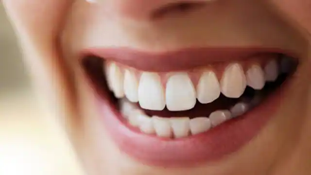 Can sensitive teeth be whitened