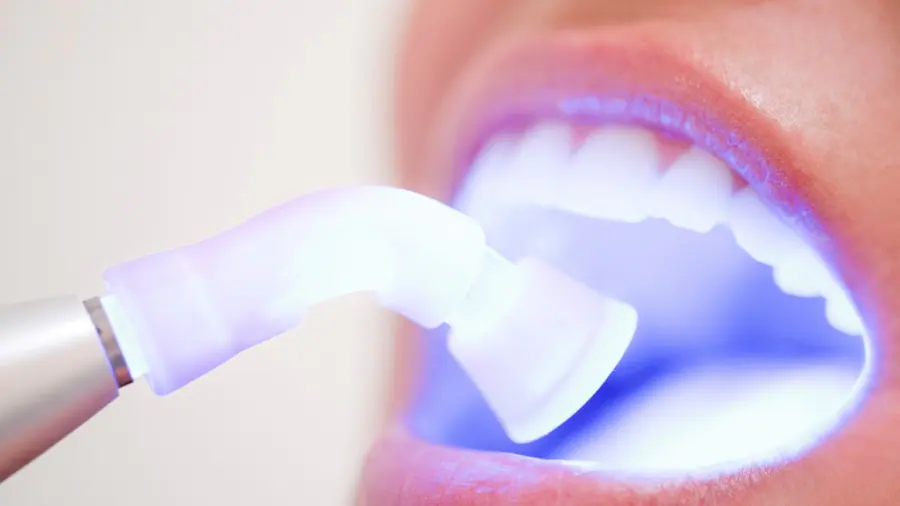 Instant teeth whitening with light