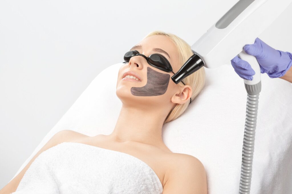 Carbon Peel Dubai ( carbon laser facial dubai 2023 )