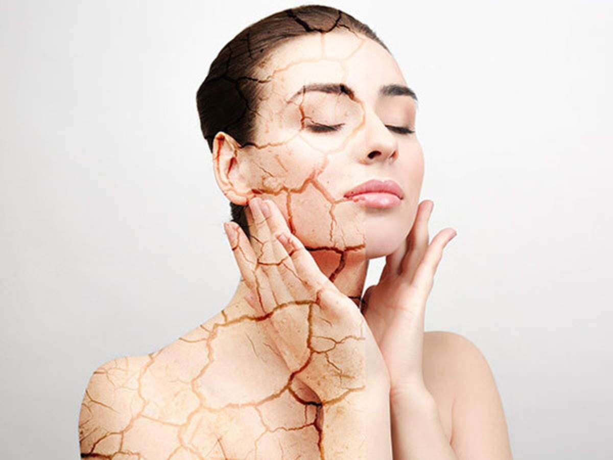 Dry Skin In Summer? 10 Ways You Can Battle It SERENITY Clinic Dubai