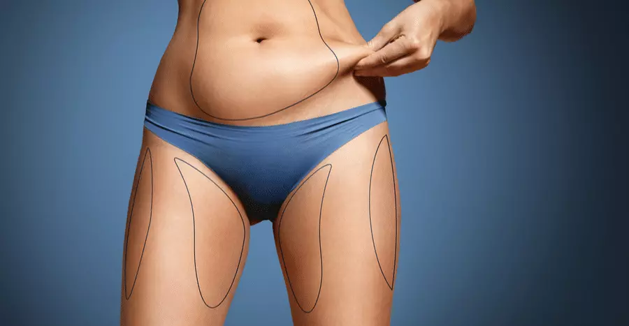 Non-invasive body contouring techniques