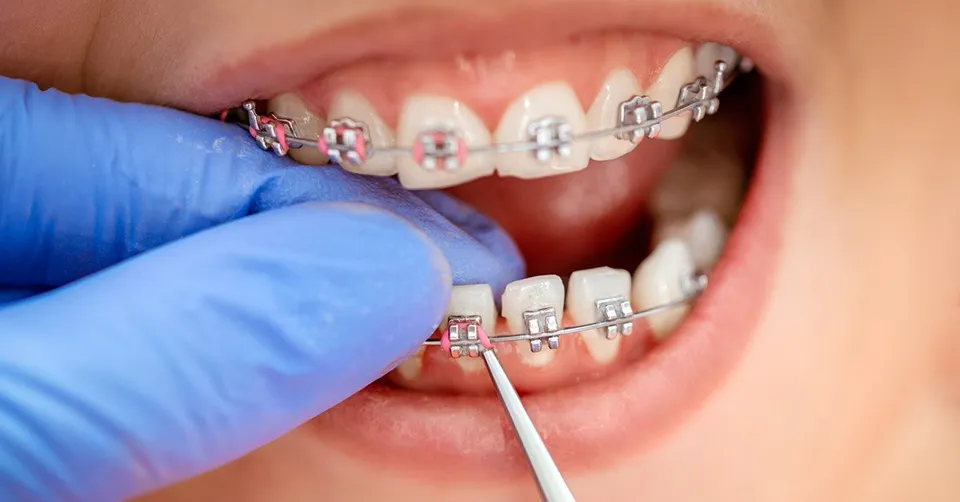 targets of some orthodontic treatments