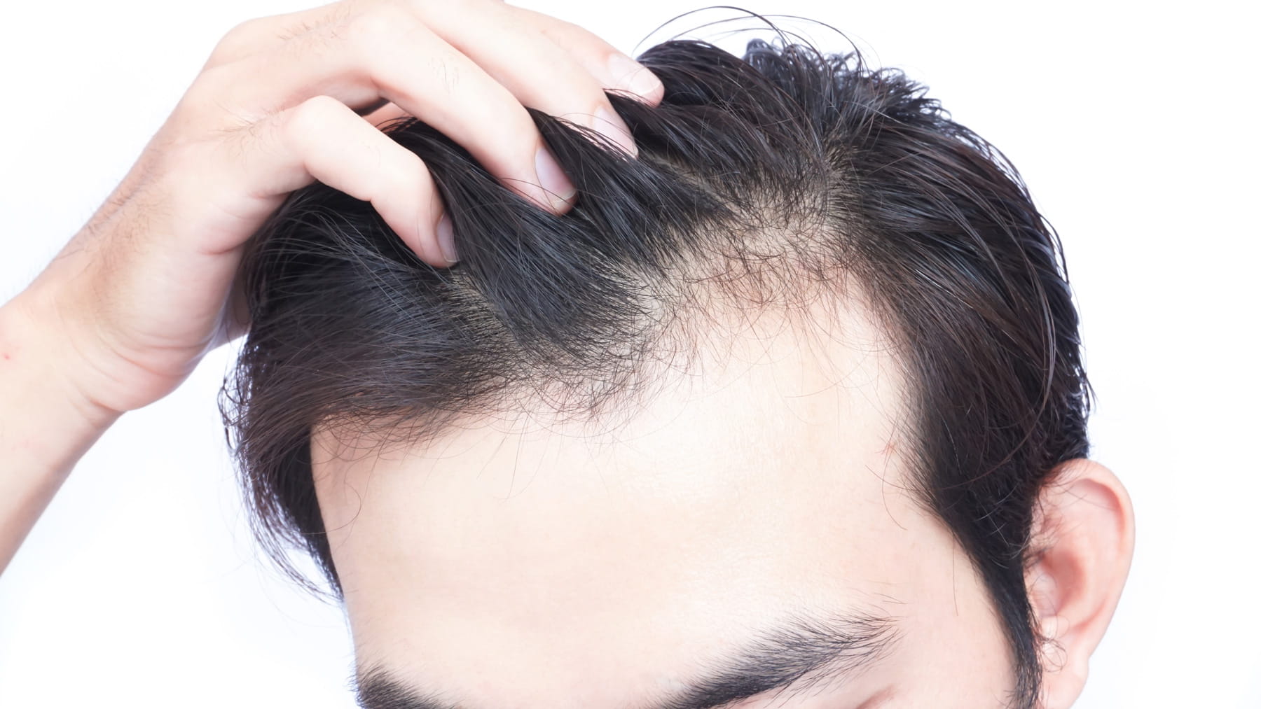 what is Hair Loss SERENITY Clinic Dubai Marina