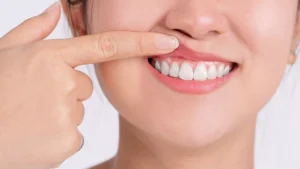 tooth abscess and its treatment 2 Causes of tooth abscess