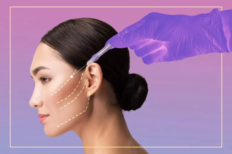 face-thread-lift-dubai/