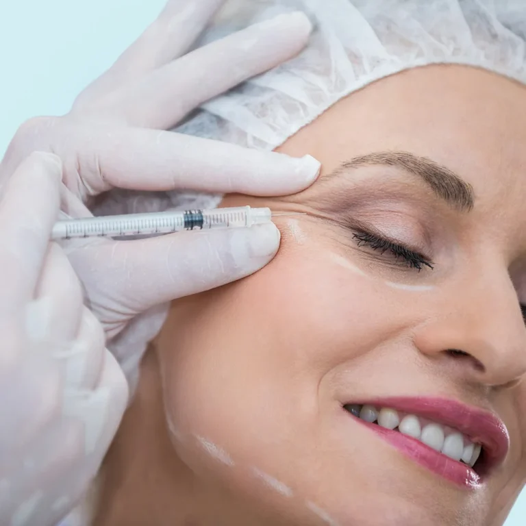 Anti Wrinkle injections 2 Serenity-Botox-01