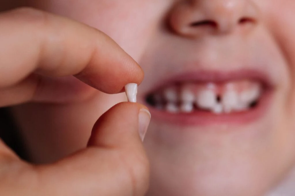 loose teeth: causes, Treatments 3 What is the cause of loose baby teeth in children
