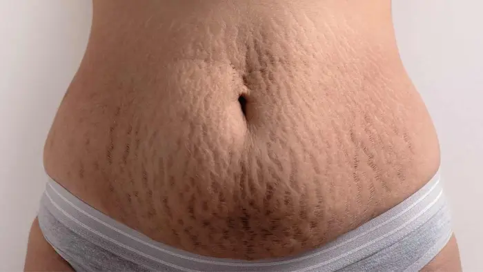 pregnancy