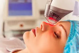 Best-rf-microneedling