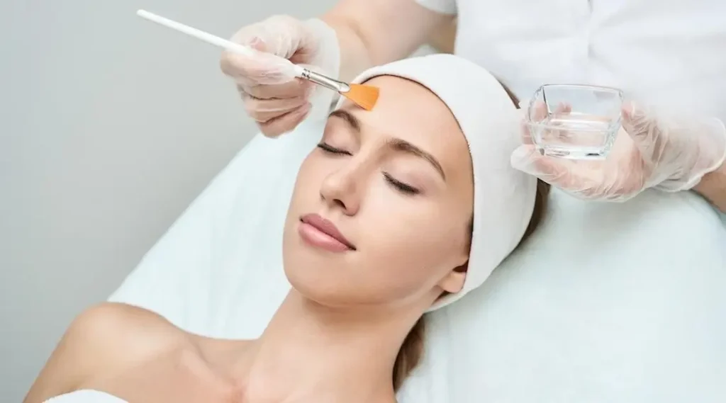 Chemical peel facial treatment for deep exfoliation and skin rejuvenation