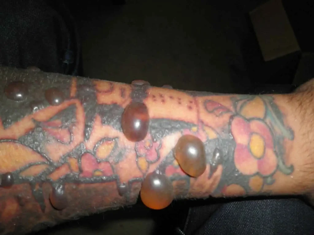 Get to know the complications of tattoo