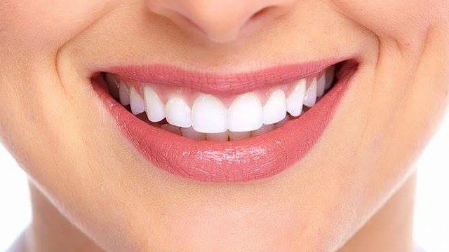 Hollywood Smile Dubai 4 Hollywood-Smile-Dubai-offers