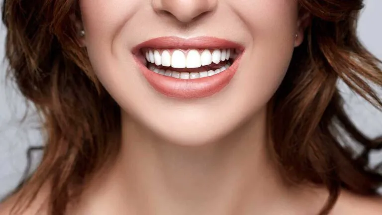 Hollywood Smile Dubai 5 Hollywood-smile-dental-clinic-Dubai