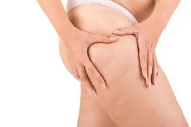 How-Long-Do-The-Results-Of-VelaShape-Last