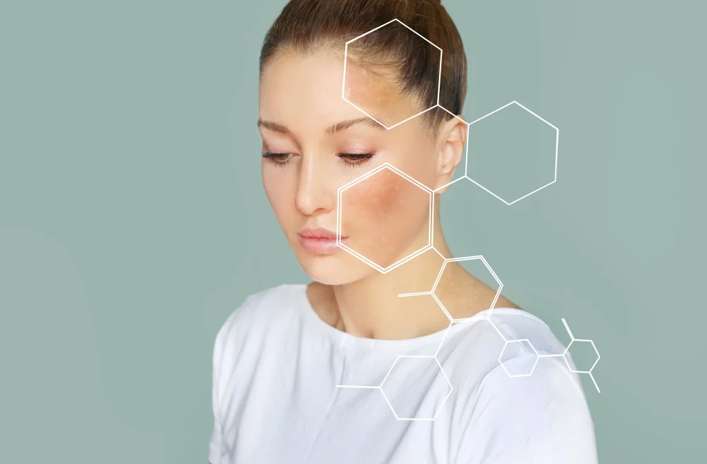 Professional Skin Analysis
