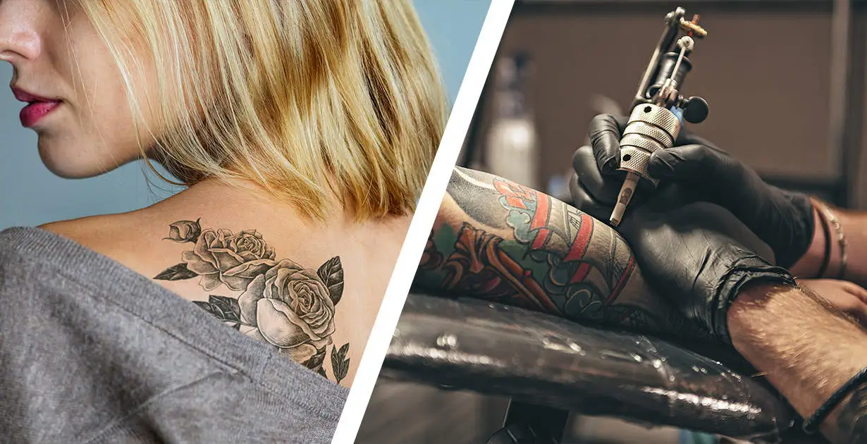 laser tattoo removal
