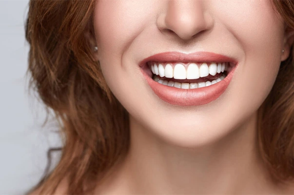 Veneers 9 veneers Dubai