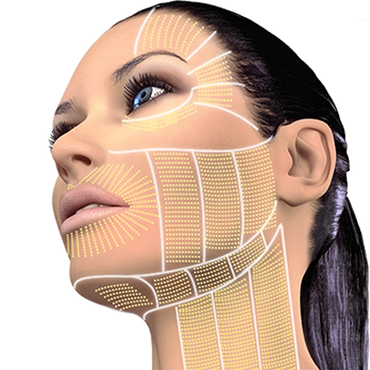 Ultherapy Treatment Dubai 4 ultherapy dubai marina