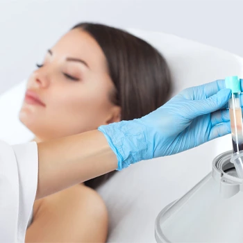 Platelet-Rich Plasma treatment 8 prp treatment Dubai