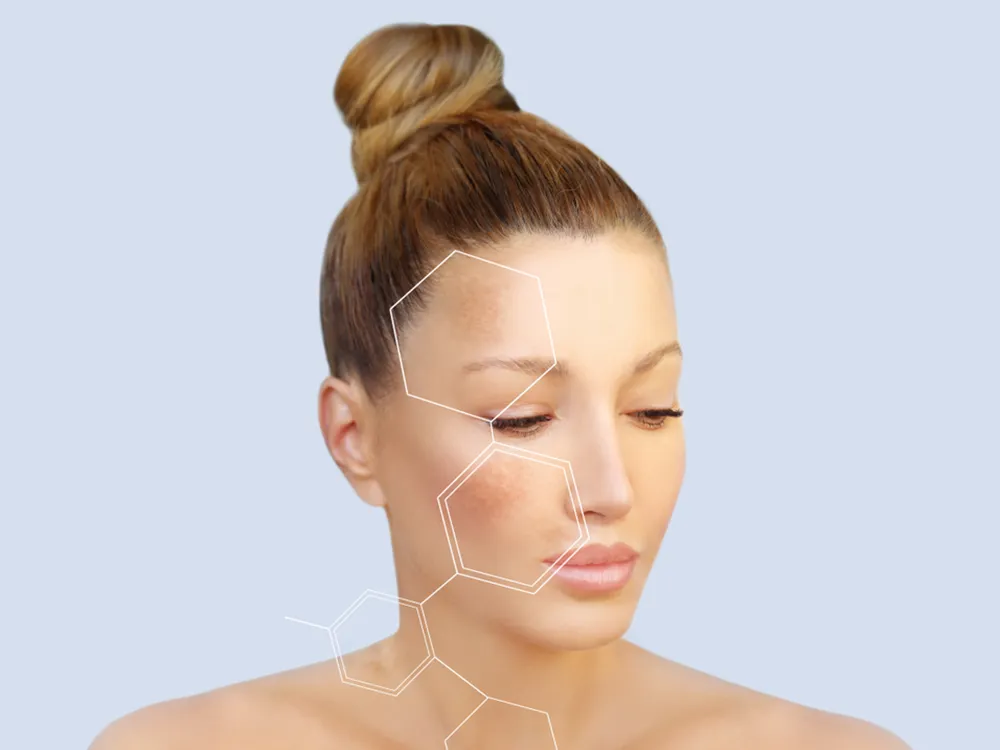 What-Does-Fractional-CO2-Laser
