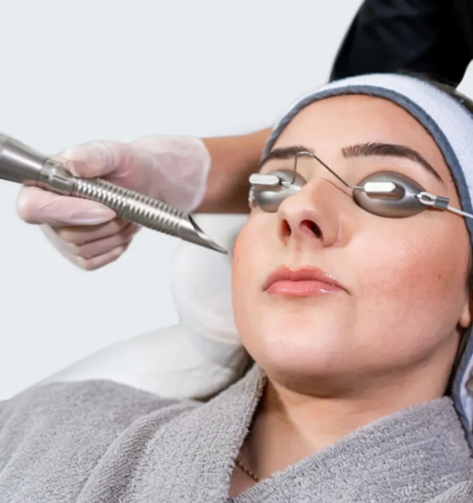best-qswitched-laser-serenity-clinic