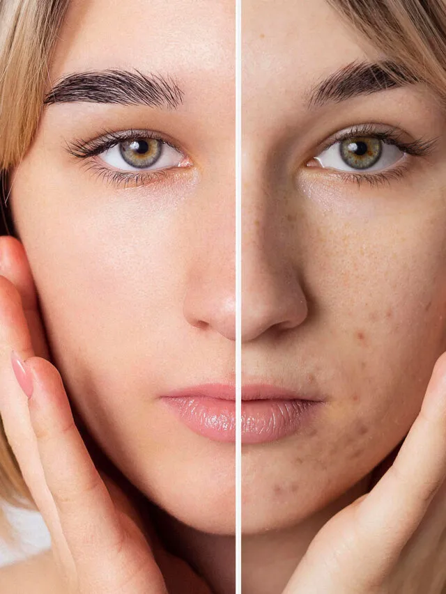 best-qswitched-laser-serenity-clinicm-dubai-marina