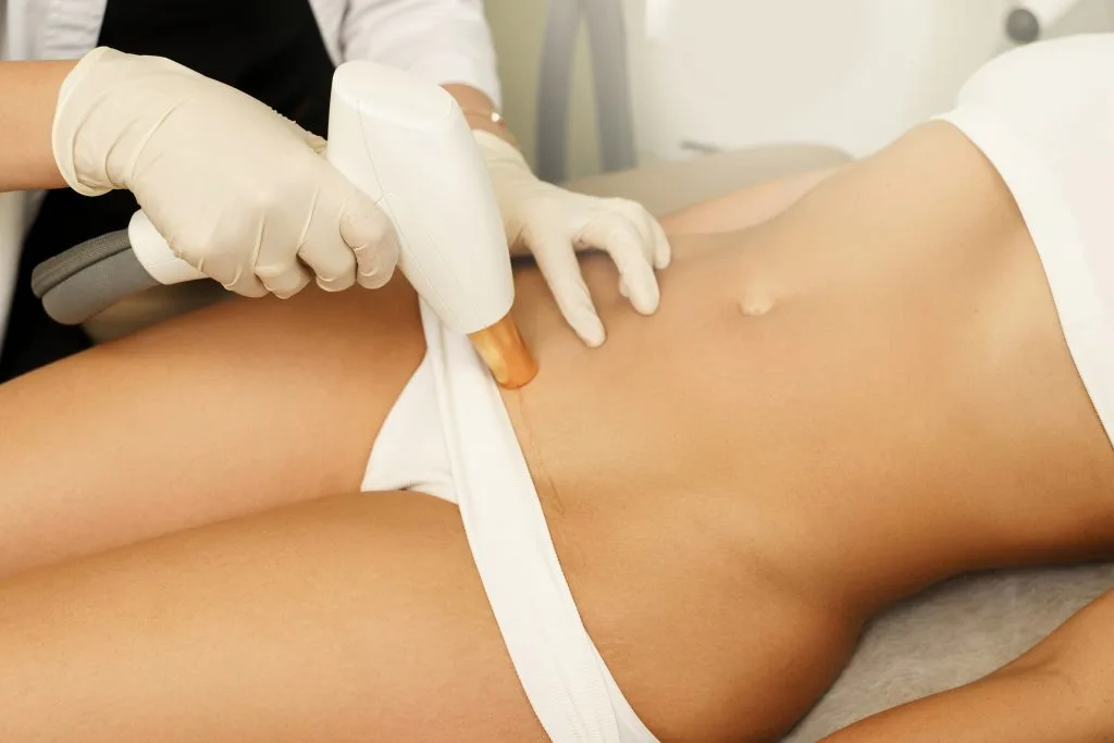 Bikini laser hair removal + post care, 5 types, side effects 3 Bikini laser hair removal safety illustration showing a comfortable treatment session.