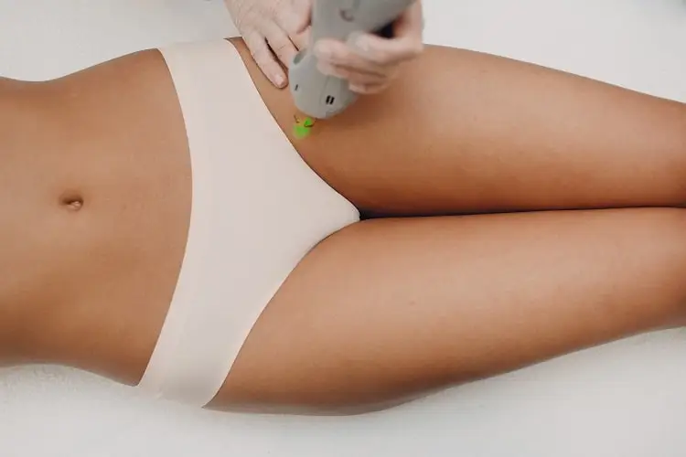 Bikini laser hair removal + post care, 5 types, side effects 5 bikini side effects