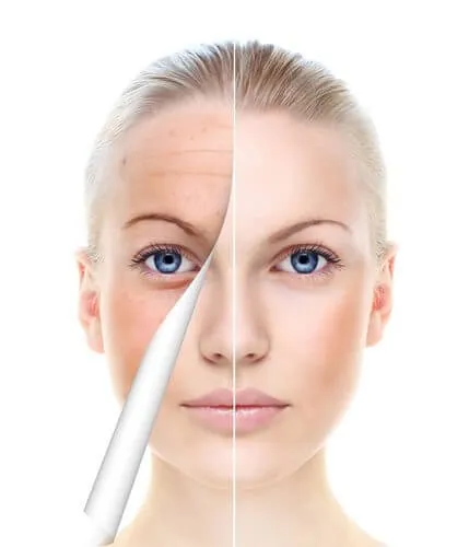 deep-skin-rejuvenation
