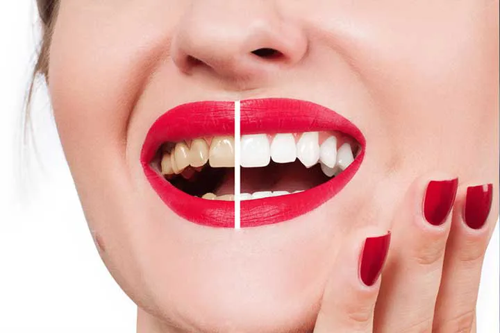 polishing-dental1