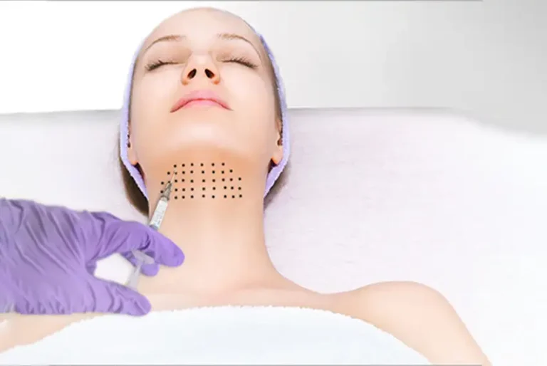 double chin mesotherapy