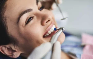 The Ultimate Guide to Dental Cleanings