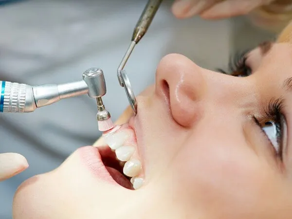 teeth-cleaning-dubai