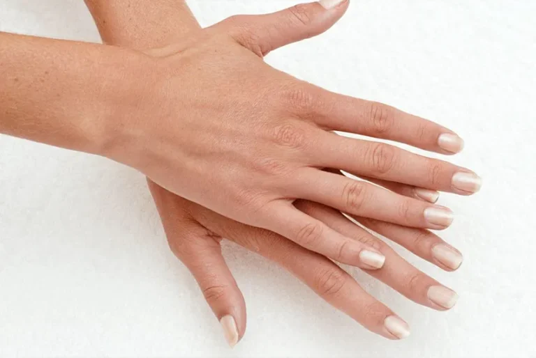 Familiarity with nail diseases