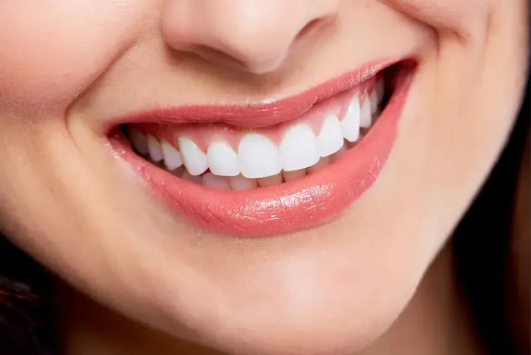 Smile design correction methods