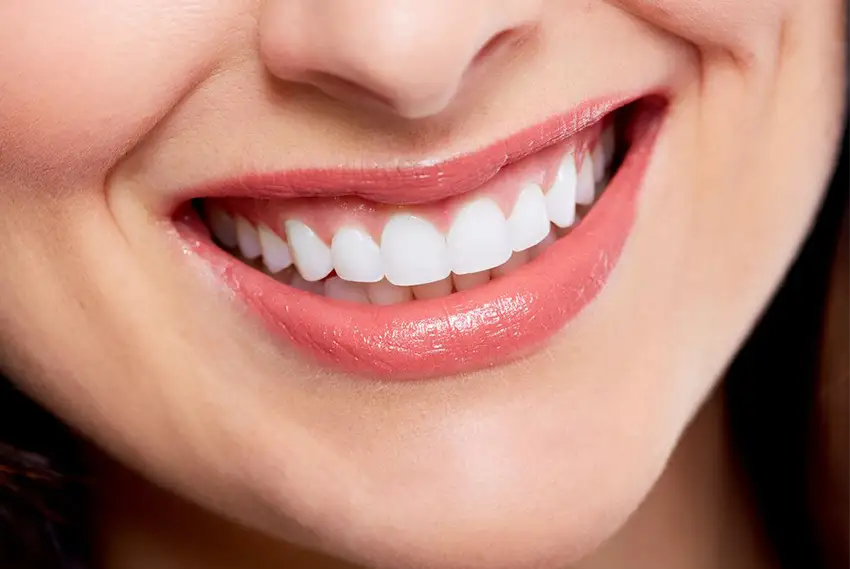 Smile design correction methods