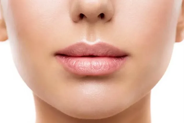 Lip Botox injection